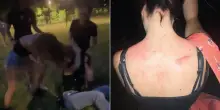 Pestaggio al parco di Scandiano, nuova versione: “Rissa pianificata dalla vittima”