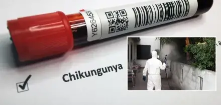 Altri due casi autoctoni di Chikungunya a Cesenatico: i malati salgono a 4