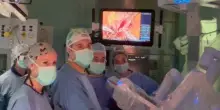 Il Policlinico fa scuola. Trapianto di emifegato con il chirurgo ’robot’. Prima volta al mondo