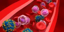 Tumori del sangue, al Sant’Orsola si allarga l’officina delle cellule ‘buone’