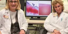 Osteoartrosi, nella lotta ecco la nuova ricerca dell’istituto Rizzoli