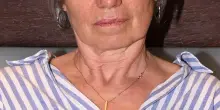 Risse e violenza in centro: "L’assessore si dimetta"