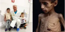 Gaza, il dottore italiano che ha curato il piccolo Osama: “Ha una malattia genetica rara. La mamma e il fratello non erano denutriti”