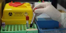 Alzheimer, via libera a test del sangue per diagnosi: cosa significa