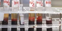 Salute, da Hiv a infezioni sessuali lotta a sommerso, al via settimana europea test