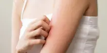 Allergie agli insetti: perché ne soffriamo e come rimediare