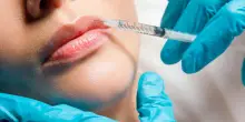 La moda del filler labbra sui social finisce male: il caso drammatico in un appartamento a Roma