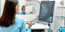 Screening mammografico, prevenzione negata a oltre 2 mln di donne