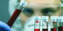 Giornata Ail, con ricerca e cura a fianco dei pazienti con neoplasie del sangue
