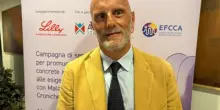Gastroenterologo Fantini: "Mici hanno impatto fisico ma anche peso psicologico e sociale"