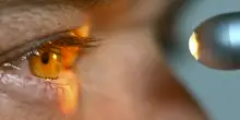Oltre 6 milioni gli italiani che convivono con patologie oculari