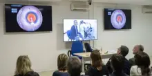 Chirurgia della cataratta, a Tor Vergata formazione con simulatore innovativo Eyesi