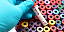 Giornata epatiti, esperti: "Raggiungere obiettivi Oms accelerare screening"