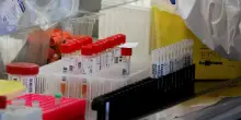Fentanyl contaminato in Argentina: morti, ricoveri e sintomi da non ignorare