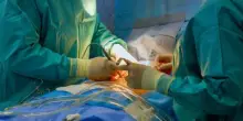 Chirurgia, a Padova innovativo intervento per cura epilessia farmaco resistente