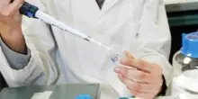 Glioblastoma, anticorpo rallenta progressione e riduce iperattività cerebrale
