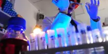 Tumori, proteina predice se cancro colon risponderà a chemio