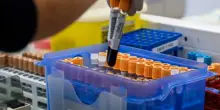 Fegato, un test per scoprire il rischio di gravi malattie entro 10 anni: lo studio