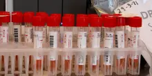 Vaccini antinfluenzali 2026: le nuove indicazioni dell’OMS