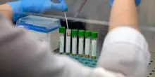 Medicina, italiani svelano errori nascosti nelle cellule: "Possibile ruolo in più malattie"