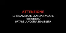 Gaza, la fame dopo due anni di guerra: file per cibo, bambini denutriti