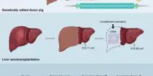 In Cina primo trapianto al mondo di fegato maiale-uomo, ha funzionato per un mese