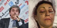 Lucia Regna massacrata dall’ex marito, la Procura di Torino impugna la sentenza di primo grado