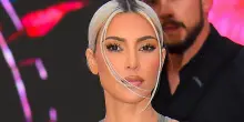 La rivelazione di Kim Kardashian: "Ho un aneurisma cerebrale"