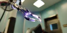 Addio brutte cicatrici. In sala operatoria arriva il robot-chirurgo