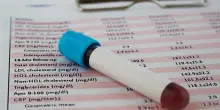 Non solo colesterolo, c’è un altro test del sangue per capire se c’è rischio infarto e ictus