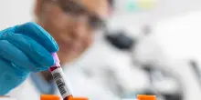 Brevettato il primo test multi-virus: li blocca prima del contagio
