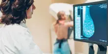 Poche adesioni agli screening: nel 2023 non individuati oltre 50mila tumori