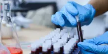 Medicina di laboratorio, cosa si rischia se si affidano all’esterno le attività