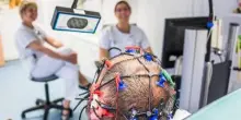 Cura da record per curare un’epilessia che non risponde ai farmaci