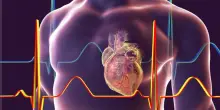 Infarto, le lesioni “pericolose” nei vasi diranno chi è a rischio recidiva grazie all’AI