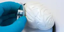 Le capacità di diagnosi neurologica dell’uomo battono quelle delle IA