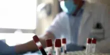 Botulino, perché l'antidoto è entrato nella scorta strategica nazionale nata dopo le Torri Gemelle