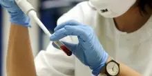 Dai sintomi del botulino a cosa fare: il decalogo per evitare l'intossicazione