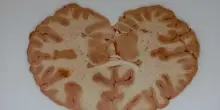 Il cervello degli uomini invecchia in modo diverso da quello delle donne