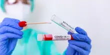 Covid, nuova mutazione rilevata in Italia: l’allarme