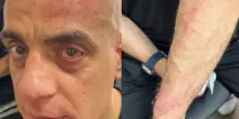 Cicalone, lo youtuber romano aggredito alla stazione di Napoli: “Qui non fate video”