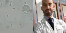“Può uccidere”. Batterio mangia-carne nelle acque del mare, l’allarme di Bassetti: cos’è e cosa si rischia