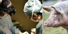 Primo trapianto di polmone da maiale a uomo, rimasto vitale per 9 giorni: traguardo storico
