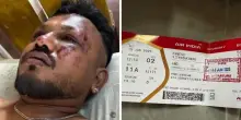 L’incredibile storia di Ramesh, l’unico sopravvissuto del disastro dell’Air India: “Un forte rumore, poi lo schianto”