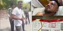 L’unico sopravvissuto del disastro dell’Air India esce dalle macerie e cammina tra la folla: l’incredibile video