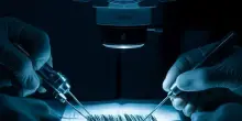 Tecnica Vita e pianificazione microscopica nel trapianto capelli?